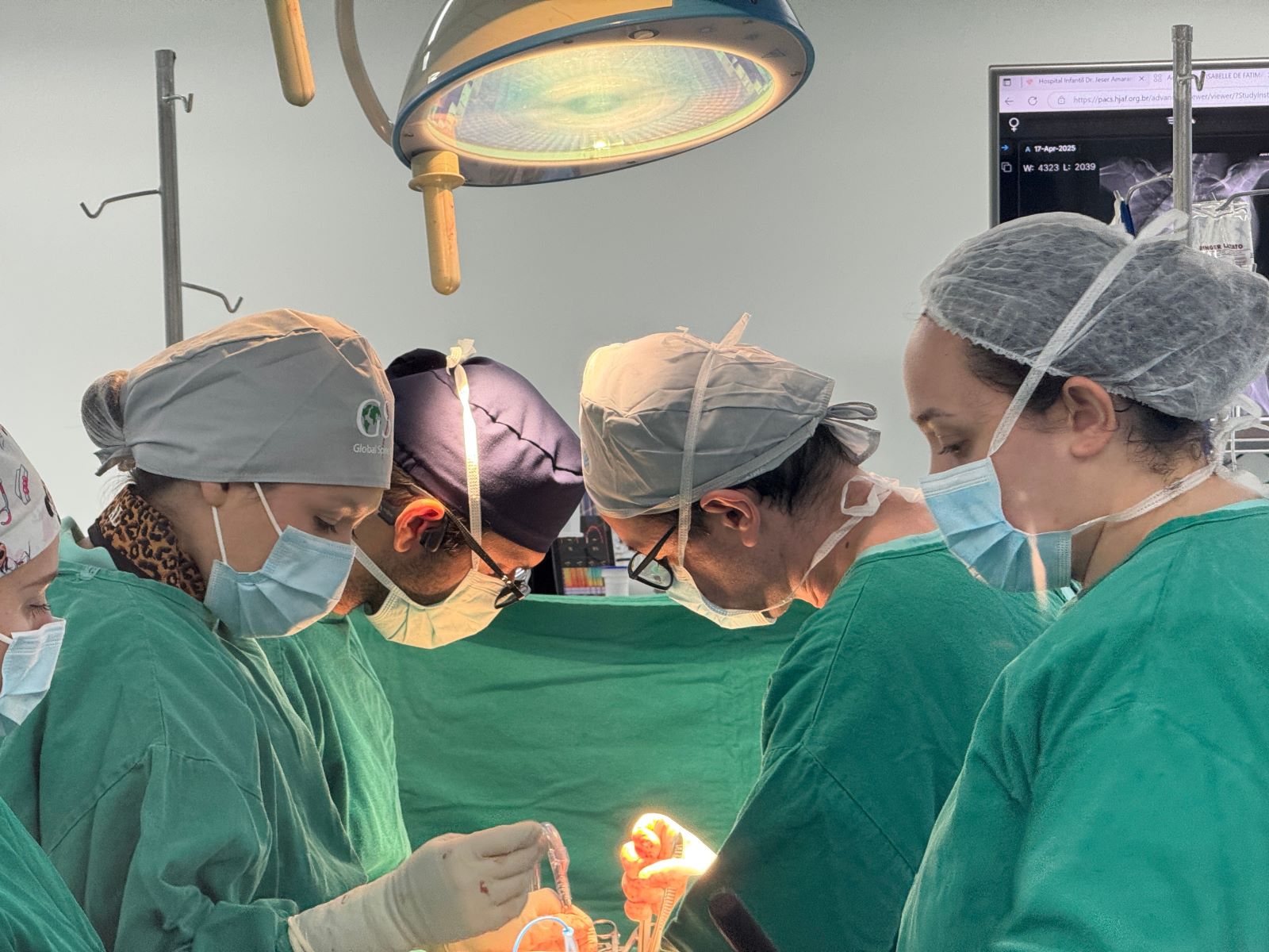 Mais de 50 pacientes pediátricos com escoliose são atendidos no Hospital Jeser Amarante Faria de Joinville